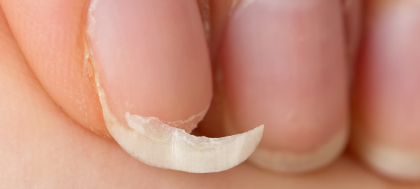 Imagem de Unha Quebraça